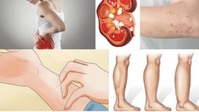Photo of If Your Kidney Is in Danger, the Body Will Give You These 8 Signs!