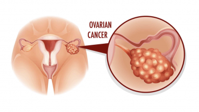 Photo of 5 Early Warning Signs of Ovarian Cancer to Never Ignore